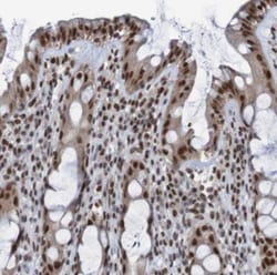 CDC5L Antibody, Novus Biologicals:Antibodies:Primary Antibodies