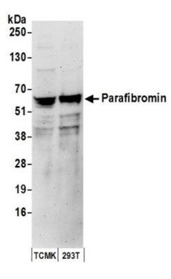 CDC73/HRPT2 Antibody, Novus Biologicals 0.1mg; Unlabeled:Antibodies, Polyclonal