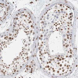 CDCA2 Antibody, Novus Biologicals 0.1mL; Unlabeled:Antibodies, Polyclonal
