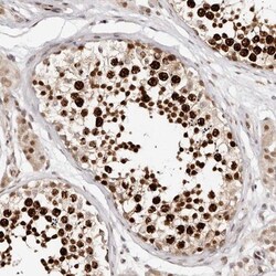 CDCA2 Antibody, Novus Biologicals 0.1mL; Unlabeled:Antikörper