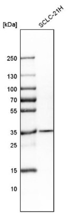 CDCA5 Antibody, Novus Biologicals:Antibodies:Primary Antibodies