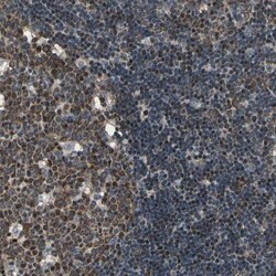 CDCA7 Antibody, Novus Biologicals 0.1 mL | Buy Online | Novus Biologicals | Fisher Scientific