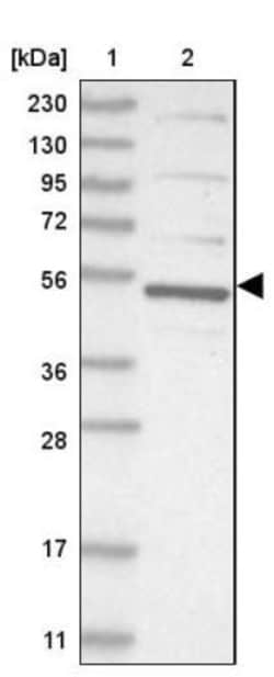 CDCA7L Antibody, Novus Biologicals 0.1mL; Unlabeled:Antibodies, Polyclonal
