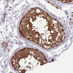 CDIP Antibody, Novus Biologicals:Antibodies:Primary Antibodies