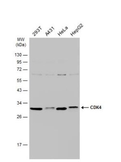 CDK4 Antibody, Novus Biologicals 0.1mg; Unlabeled:Antibodies, Polyclonal