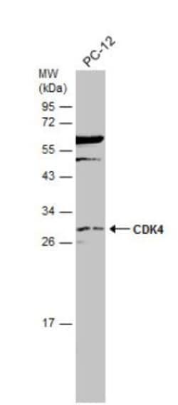 CDK4 Antibody, Novus Biologicals 0.1mg; Unlabeled:Antibodies, Polyclonal