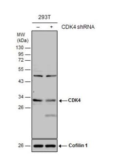 CDK4 Antibody, Novus Biologicals 0.1mg; Unlabeled:Antibodies, Polyclonal