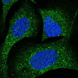 CDK5RAP3 Antibody, Novus Biologicals 0.1mL; Unlabeled:Antibodies, Polyclonal