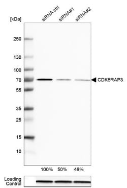 Aminopeptidase B/RNPEP Antibody, Novus Biologicals:Antibodies:Primary Antibodies