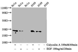 CDKN3, p Thr14 Antibody (4C12), Novus Biologicals 100 &mu;g | Buy Online | Novus Biologicals | Fisher Scientific