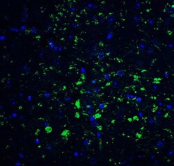 CDNF Antibody - BSA Free, Novus Biologicals 0.1mg; Unlabeled:Antibodies,