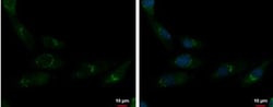 CDP/CUTL1 Antibody, Novus Biologicals 0.1mL; Unlabeled:Antibodies, Polyclonal