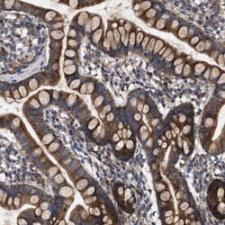 CDR2L Antibody, Novus Biologicals:Antibodies:Primary Antibodies