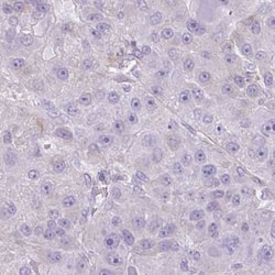 CDRT15 Antibody, Novus Biologicals 25 &mu;L, Unlabeled:Antibodies, Polyclonal