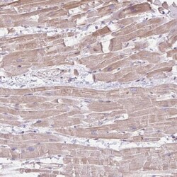 CDRT15 Antibody, Novus Biologicals 25 &mu;L, Unlabeled:Antibodies, Polyclonal