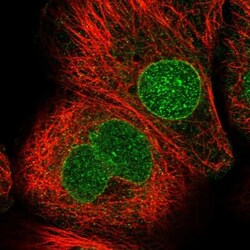 CDS1 Antibody, Novus Biologicals 0.1mL; Unlabeled:Antibodies, Polyclonal