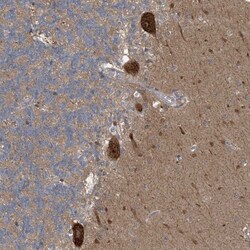 CDS1 Antibody, Novus Biologicals 0.1mL; Unlabeled:Antibodies, Polyclonal