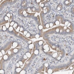 CDS1 Antibody, Novus Biologicals 0.1mL; Unlabeled:Antibodies, Polyclonal