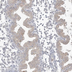 CDS1 Antibody, Novus Biologicals 0.1mL; Unlabeled:Antibodies, Polyclonal