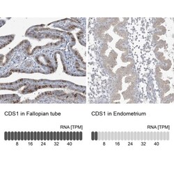 CDS1 Antibody, Novus Biologicals 0.1mL; Unlabeled:Antibodies, Polyclonal