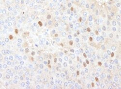 CDT1 Antibody, Novus Biologicals 100 &mu;L | Buy Online | Novus Biologicals | Fisher Scientific