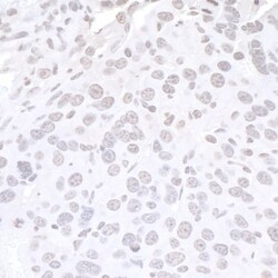 CDT2 Antibody, Novus Biologicals 0.1mL; Unlabeled:Antibodies, Polyclonal