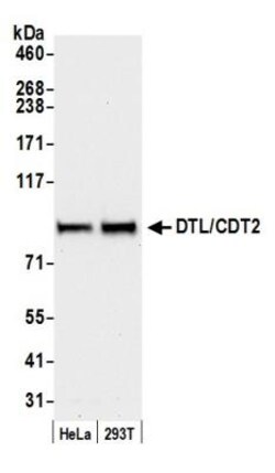 CDT2 Antibody, Novus Biologicals 0.1mL; Unlabeled:Antibodies, Polyclonal