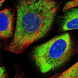 CDV3 Antibody, Novus Biologicals:Antibodies:Primary Antibodies