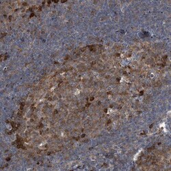 CDV3 Antibody, Novus Biologicals:Antibodies:Primary Antibodies