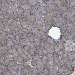 CDV3 Antibody, Novus Biologicals:Antibodies:Primary Antibodies