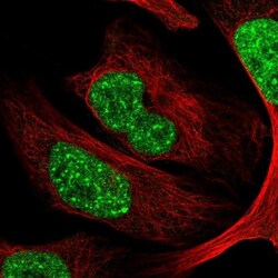 CDYL Antibody, Novus Biologicals 0.1mL; Unlabeled:Antibodies, Polyclonal