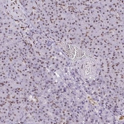 CDYL Antibody, Novus Biologicals 0.1mL; Unlabeled:Antibodies, Polyclonal