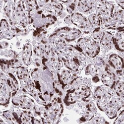 CDYL Antibody, Novus Biologicals 0.1mL; Unlabeled:Antibodies, Polyclonal