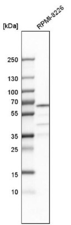 CDYL Antibody, Novus Biologicals 0.1mL; Unlabeled:Antibodies, Polyclonal