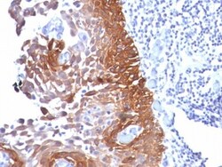 Cytokeratin 18 Antibody (Cocktail), Novus Biologicals 0.2mg; Unlabeled:Antibodies,