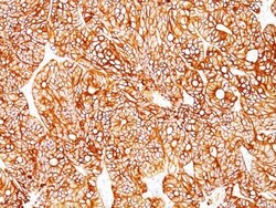 Cytokeratin 18 Antibody (Cocktail), Novus Biologicals 0.2mg; Unlabeled:Antibodies,