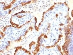 Cytokeratin 18 Antibody (Cocktail), Novus Biologicals 0.2mg; Unlabeled:Antibodies,