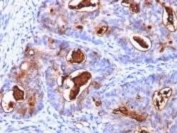 CEACAM5/CD66e Antibody (C66/1260), Novus Biologicals 0.2mg; Unlabeled:Antibodies,