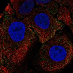CEACAM5/CD66e Antibody, Novus Biologicals 25 &mu;L; Unlabeled:Antibodies,