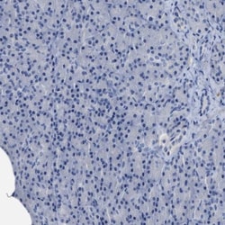 CEACAM5/CD66e Antibody, Novus Biologicals 25 &mu;L; Unlabeled:Antibodies,