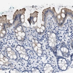CEACAM5/CD66e Antibody, Novus Biologicals 25 &mu;L; Unlabeled:Antibodies,
