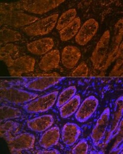 CEACAM6/CD66c Rabbit anti-Human, Mouse, Rat, Clone: 4Z3V7, Novus Biologicals 100 &mu;g | Buy Online | Novus Biologicals | Fisher Scientific