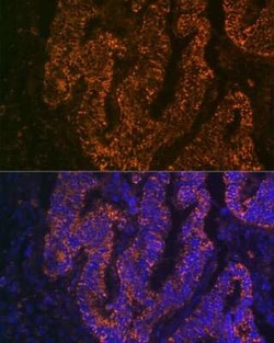 CEACAM6/CD66c Rabbit anti-Human, Mouse, Rat, Clone: 4Z3V7, Novus Biologicals 100 &mu;g | Buy Online | Novus Biologicals | Fisher Scientific