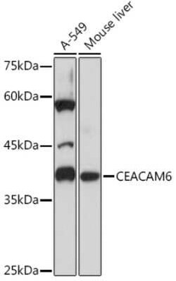CEACAM6/CD66c Rabbit anti-Human, Mouse, Rat, Clone: 4Z3V7, Novus Biologicals 100 &mu;g | Buy Online | Novus Biologicals | Fisher Scientific