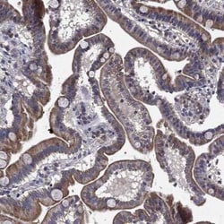 CEACAM7 Rabbit anti-Human, Polyclonal, Novus Biologicals:Antibodies:Primary