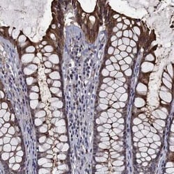 CEACAM7 Rabbit anti-Human, Polyclonal, Novus Biologicals:Antibodies:Primary