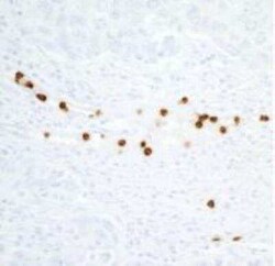 CEACAM8/CD66b Antibody (BLR111H), Novus Biologicals 100 &mu;g; Unconjugated:Antibodies,