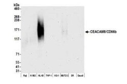 CEACAM8/CD66b Antibody (BLR111H), Novus Biologicals 100 &mu;g; Unconjugated:Antibodies,