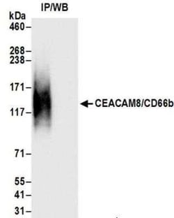 CEACAM8/CD66b Antibody (BLR111H), Novus Biologicals 100 &mu;g; Unconjugated:Antibodies,