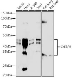 CEBP Beta Rabbit anti-Human, Mouse, Rat, Clone: 9W4A10, Novus Biologicals:Antibodies:Primary